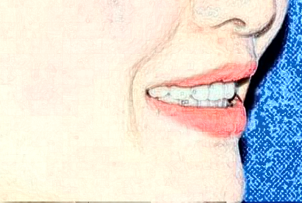 大慶市人民醫(yī)院口腔科種植牙做的好嗎?誰(shuí)做得好