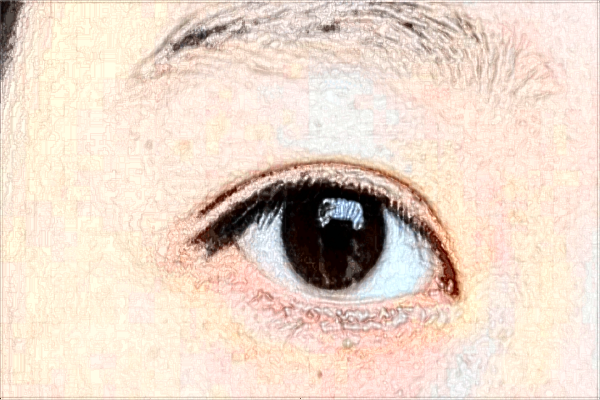 2024煙臺(tái)毓璜頂醫(yī)院近視眼激光手術(shù)價(jià)格?近視眼激光手術(shù)的風(fēng)險(xiǎn)