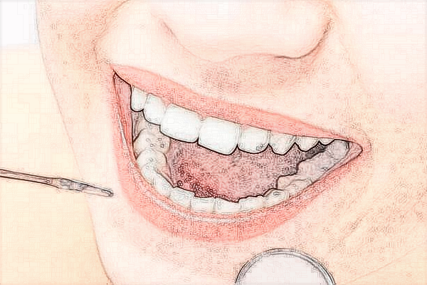 珠海市人民醫(yī)院正畸醫(yī)生怎么樣?2024正畸收費(fèi)貴嗎