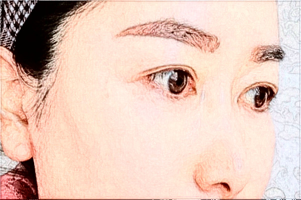 2024揚州市第一人民醫(yī)院去眼袋價格是多少?那個醫(yī)生好