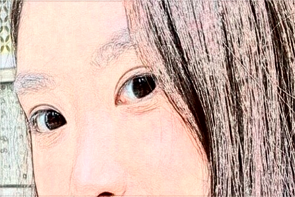 2024吉林大學第一醫(yī)院全飛秒做的好嗎?誰做得好