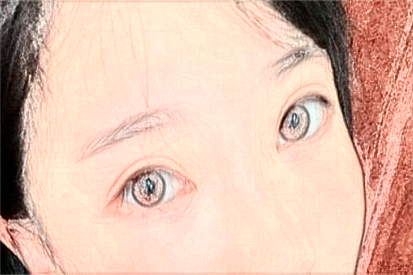 2024鎮(zhèn)江江濱醫(yī)院全飛秒怎么樣?哪個(gè)醫(yī)生做的比較好