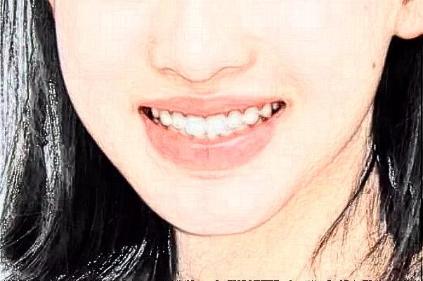 2024大連新華醫(yī)院口腔科牙列畸形矯正怎么樣_醫(yī)生名單推薦