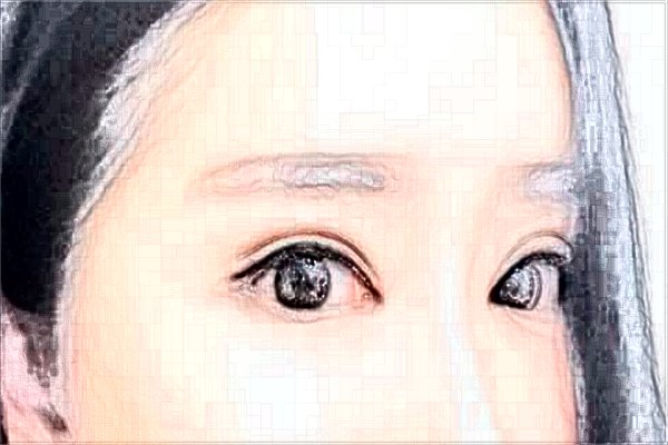 2024南京中大醫(yī)院割眼皮怎么樣_醫(yī)生名單推薦