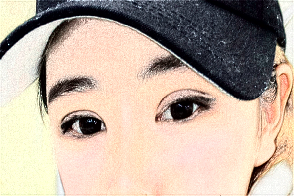 2024溫州醫(yī)學(xué)院附屬第二醫(yī)院近視手術(shù)怎么樣_醫(yī)生名單推薦