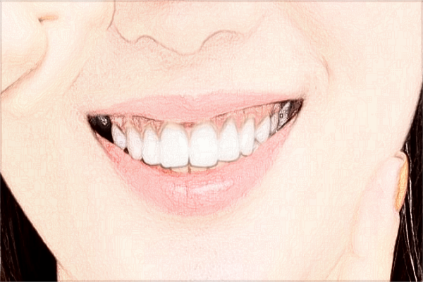 2024惠州市中心人民醫(yī)院拔牙價錢?拔牙需要多少時間