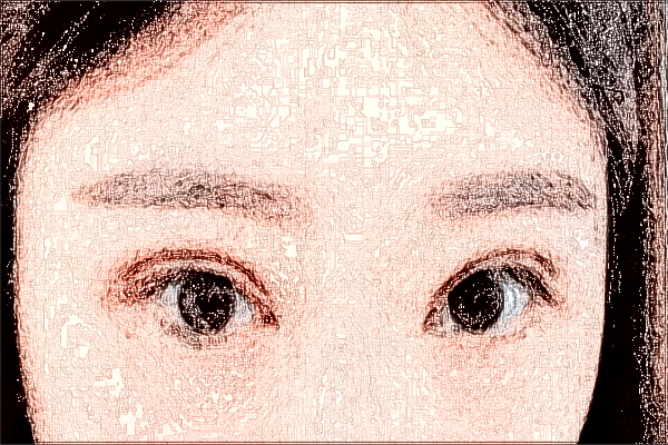 常德市第一人民醫(yī)院近視手術(shù)怎么樣?2024飛秒手術(shù)價格貴嗎