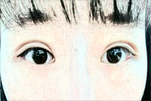 安徽省立醫(yī)院整形外科哪個(gè)醫(yī)生好_醫(yī)生排名介紹