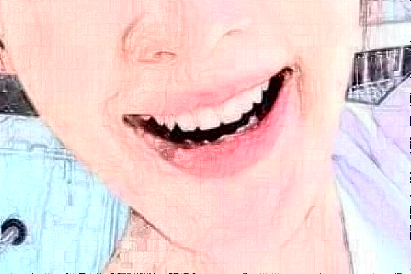 大連大學(xué)附屬新華醫(yī)院正畸做的好嗎?誰(shuí)做得好