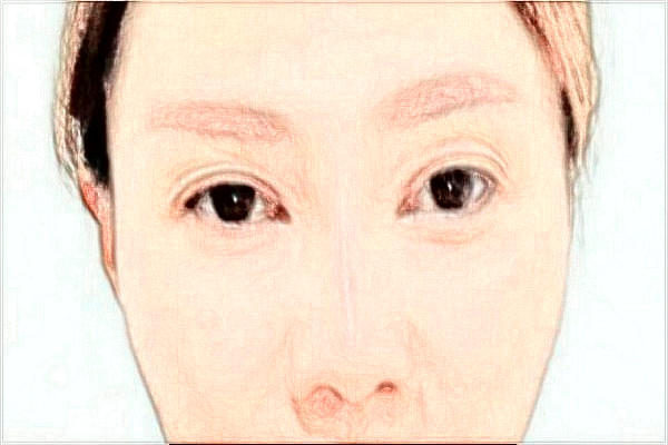 綿陽市中心醫(yī)院激光美容怎么樣_真實案例反饋