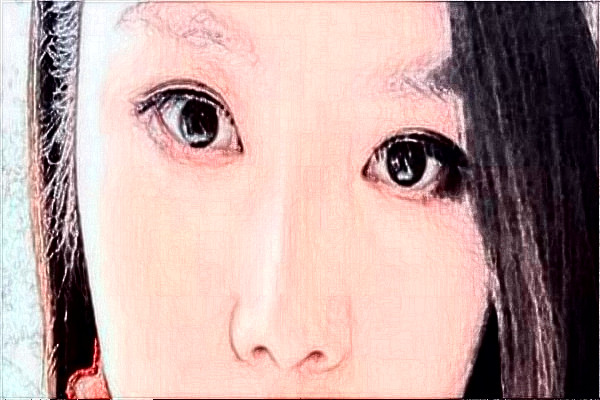 揚(yáng)州市第一人民醫(yī)院割雙眼皮技術(shù)好嗎?醫(yī)生介紹