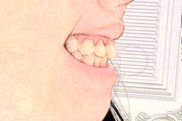 2024安徽省立醫(yī)院牙齒不齊矯正做的怎么樣_哪位醫(yī)生技術比較好