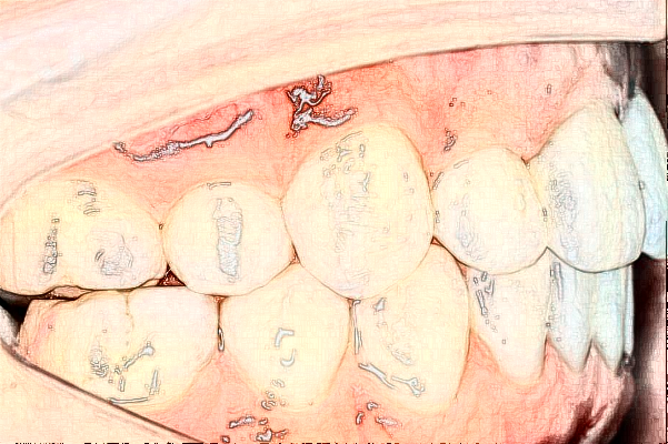 2024天津市兒童醫(yī)院兒童口腔做的好嗎?誰做得好