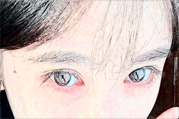 2024無(wú)錫市第一人民醫(yī)院激光去紋眉做的可以嗎？