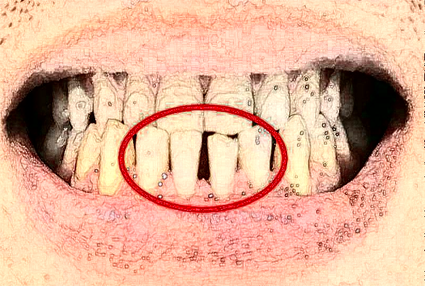 2024大連新華醫(yī)院口腔科隱形正畸價目表(價格表)口碑怎么樣