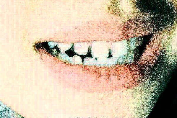 南京中大醫(yī)院口腔科美容修復價目表(價格表)口碑怎么樣