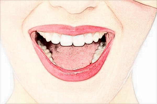 2024常德市第一人民醫(yī)院拔智齒怎么樣?拔智齒有風(fēng)險嗎