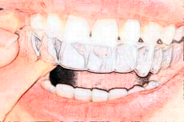 2024安徽省立醫(yī)院牙齒正畸怎么樣_誰做得好