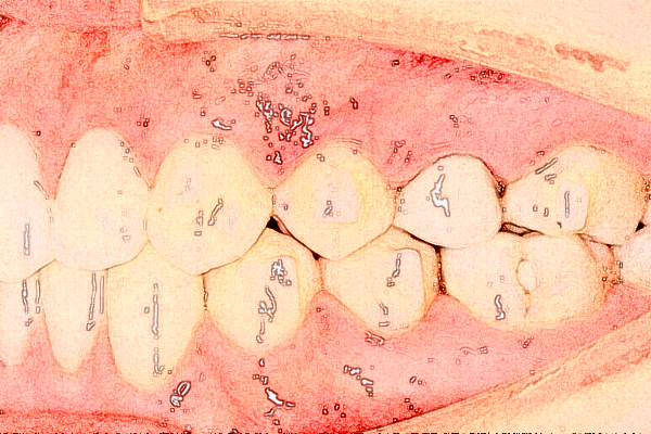 揚(yáng)州市第一人民醫(yī)院牙列不齊矯正醫(yī)生排名_口碑+價(jià)格