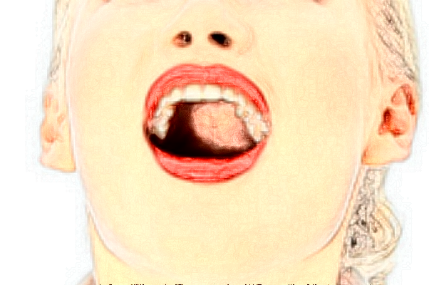 延邊醫(yī)院牙齒美白怎么樣?全新案例分享