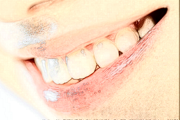 大慶市人民醫(yī)院口腔科隱形矯正價(jià)格多少?做的怎么樣