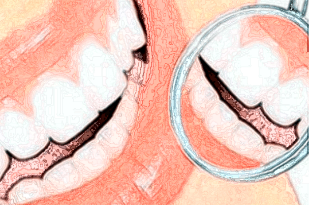 2024吉林大學第一醫(yī)院口腔科根管怎么樣_整形日記分享