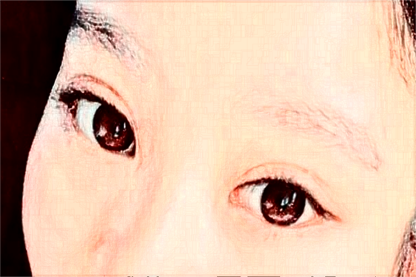 2024懷化市第一人民醫(yī)院全飛秒多少錢?2024全飛秒價格