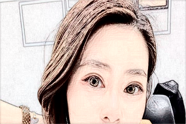 海口市人民醫(yī)院醫(yī)美怎么樣?醫(yī)美項(xiàng)目都有哪些