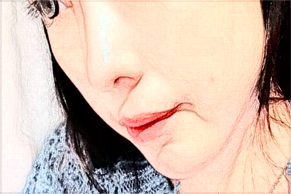 蘭州大學第二醫(yī)院整形美容科怎么樣?可以隆鼻嗎