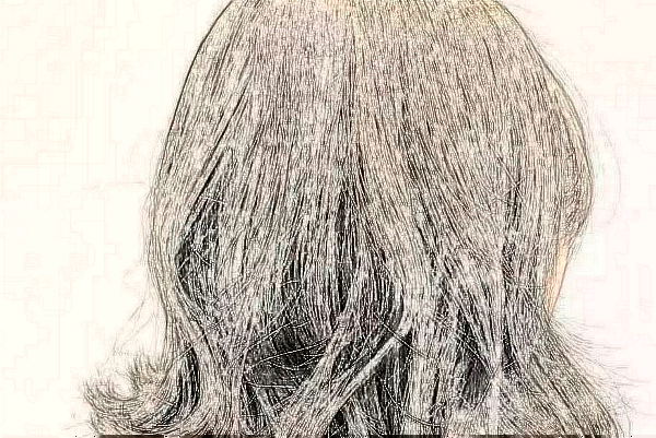 2024佛山市第二人民醫(yī)院植發(fā)要多少錢?植發(fā)的危害