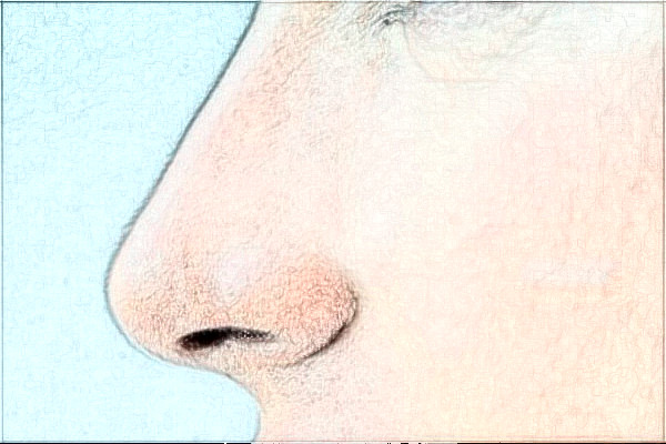 2024安徽省立醫(yī)院隆鼻怎么樣_誰做得好