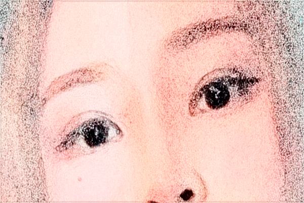 2024安徽省立醫(yī)院開眼角怎么樣_誰做得好