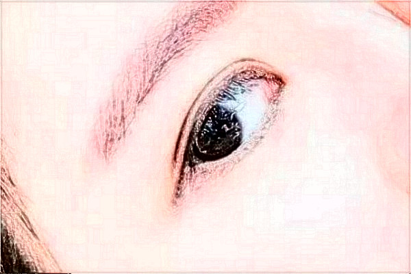 2024延邊醫(yī)院去除眼袋案例反饋，做過(guò)的都說(shuō)不錯(cuò)