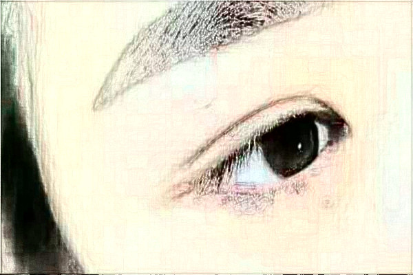 2024延邊醫(yī)院去除眼袋案例反饋，做過(guò)的都說(shuō)不錯(cuò)