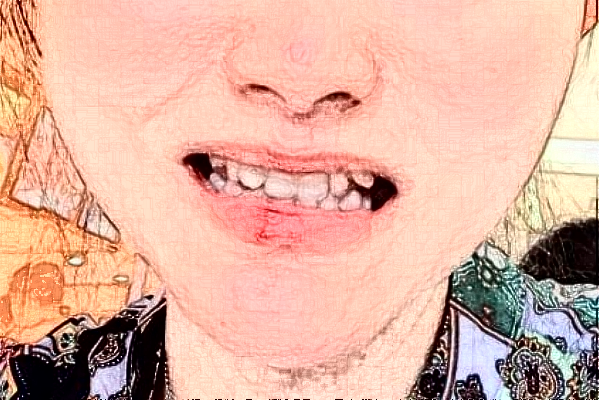 2024蘇州姑蘇美奧口腔牙綜合怎么樣_整形日記分享