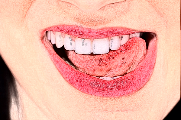 2024天津市第三中心醫(yī)院口腔科牙齒排列畸形矯治價(jià)目表(價(jià)格表)怎么樣