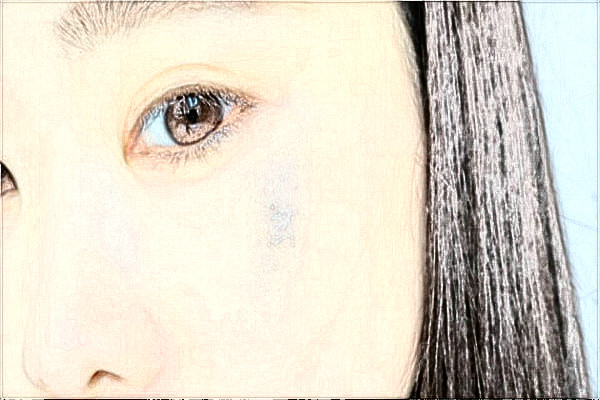 南京鼓樓醫(yī)院去胎記做的好嗎？誰做的好