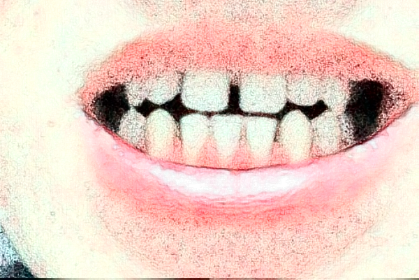 沈陽盛京醫(yī)院烤瓷冠修復(fù)價(jià)目表(價(jià)格表)怎么樣