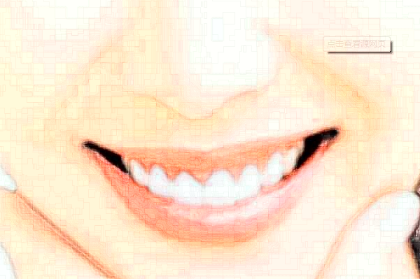 徐州醫(yī)科大學附屬醫(yī)院拔牙怎么樣_整形日記分享