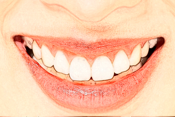 2024徐州醫(yī)科大學(xué)附屬醫(yī)院種植牙做的好嗎_醫(yī)生推薦