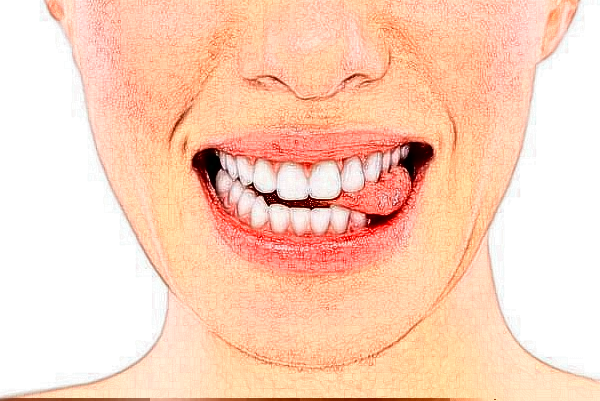 沈陽盛京醫(yī)院補牙好不好?體驗日記反饋