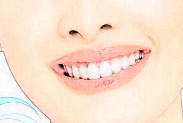 沈陽盛京醫(yī)院補牙好不好?體驗日記反饋