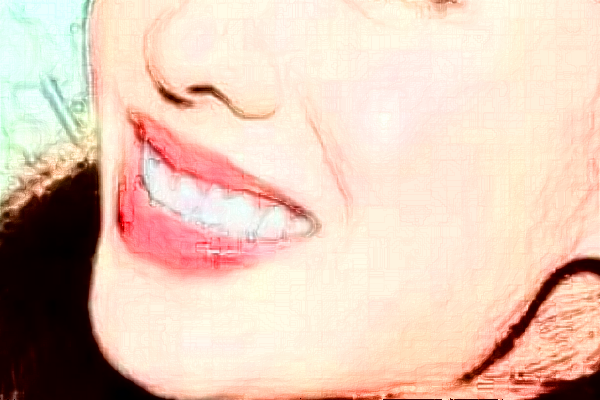 2024株洲市中心醫(yī)院補牙多少錢—顆?正畸科可以補牙嗎