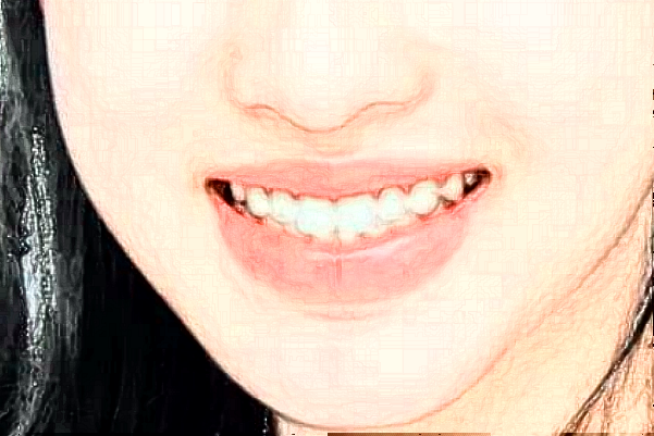 蘭州大學(xué)第二醫(yī)院口腔頜面外科是做什么的?頜面外科手術(shù)案例