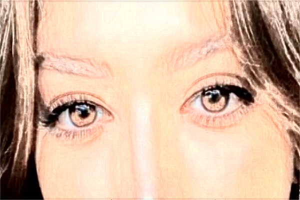 2024株洲市中心醫(yī)院雙眼皮手術(shù)收費價格?割雙眼皮好嗎