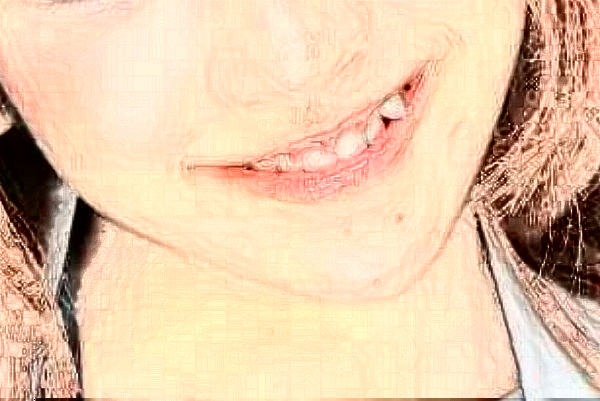 2024安徽醫(yī)科大學(xué)第一附屬醫(yī)院全瓷牙做的好嗎?哪位醫(yī)生做得好