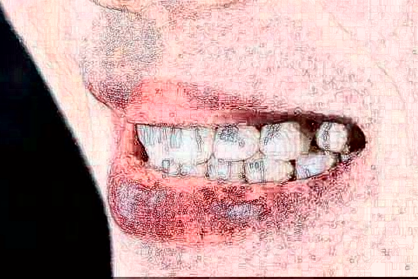 2024安徽醫(yī)科大學(xué)第一附屬醫(yī)院全瓷牙做的好嗎?哪位醫(yī)生做得好