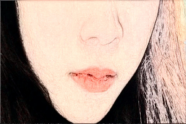 2024安徽醫(yī)科大學第一附屬醫(yī)院祛斑價格需要多少_真實案例分享