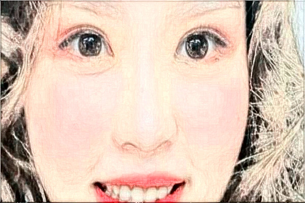 丹東市第一醫(yī)院割雙眼皮做的好嗎_案例_價(jià)格