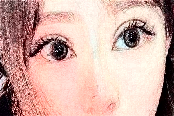 徐州醫(yī)科大學附屬醫(yī)院去眼袋做的好嗎?哪位醫(yī)生做得好